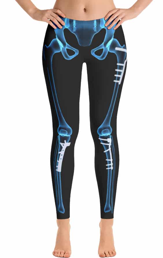 Skeleton X-ray Legging With Bone Plates & Screws - Designed By